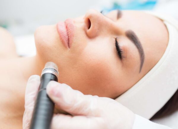 radiofrekwencja mikroigłowa