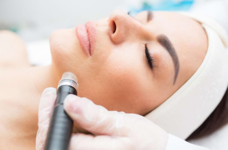 radiofrekwencja mikroigłowa