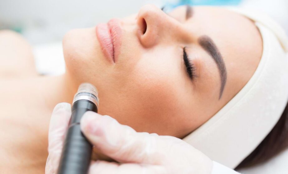 radiofrekwencja mikroigłowa